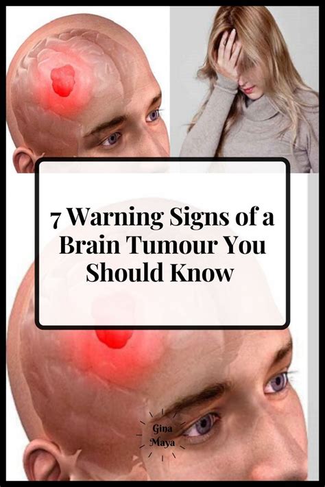 7 Warning Signs Of A Brain Tumour You Should Know