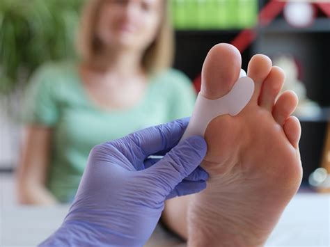 Bunion Correction Surgery Types Treatment Recovery Orthopedic