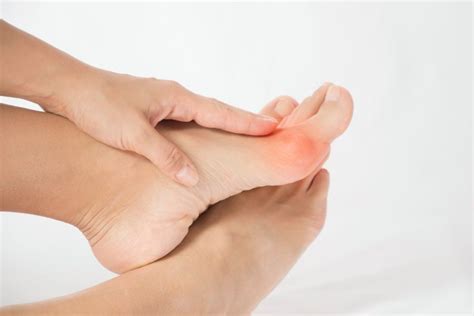 Bunion Treatment At Home Beyond Podiatry