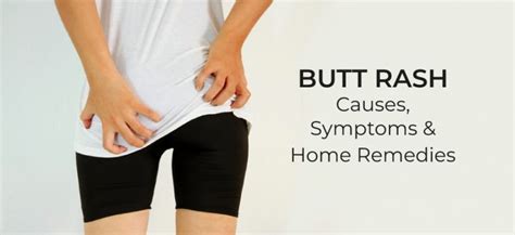 Butt Rash Possible Causes Symptoms Remedies Daily Health Cures