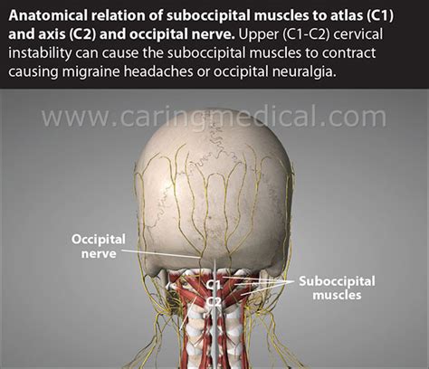 Can Botulinum Toxin Injections For Headaches Make Your Symptoms Worse