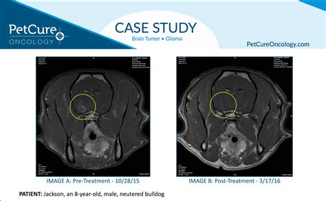 Case Study Treating Glial Brain Tumors In Dogs With Stereotactic