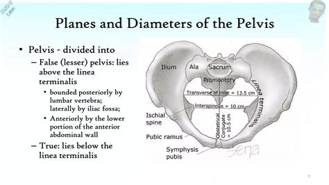 Cephalopelvic Disproportion 2021 Ppt