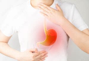 Cough From Acid Reflux And How To Treat It With Homeopathy Homeopathy At Drhomeo Com