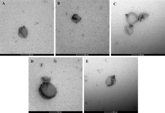 Deep Learning Based Segmentation Of Small Extracellular Vesicles In Transmission Electron