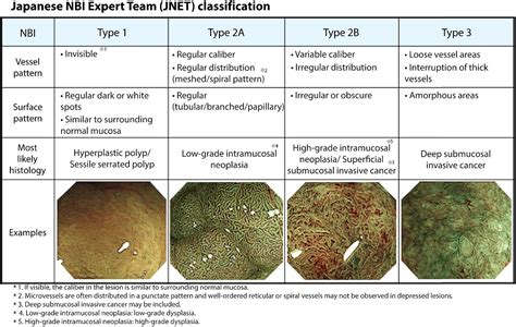 Endoscopic Recognition And Classification Of Colorectal Polyps