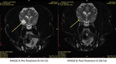 French Bulldog Thrives Following Treatment Of Brain Tumor Via New