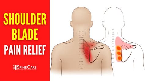 How To Treat Back Pain Under Left Shoulder Blade Scapula