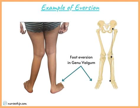 Inversion Vs Eversion In Anatomy Nurseship