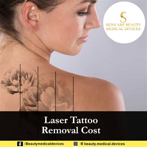 Laser Tattoo Removal Cost Beauty Medical Devices