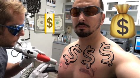 Laser Tattoo Removal Cost How Much Youtube