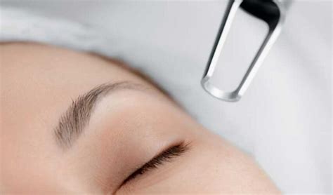 Laser Treatment For Dark Spots