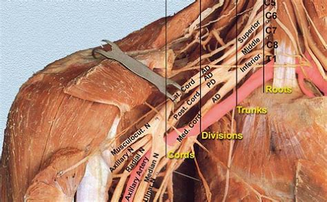 Miscellaneous Medicineisnotmerchandise Brachial Plexus Brachial