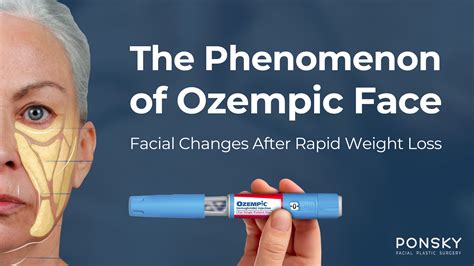 Ozempic Face Can Weight Loss Drug Cause Facial Aging Arrow News