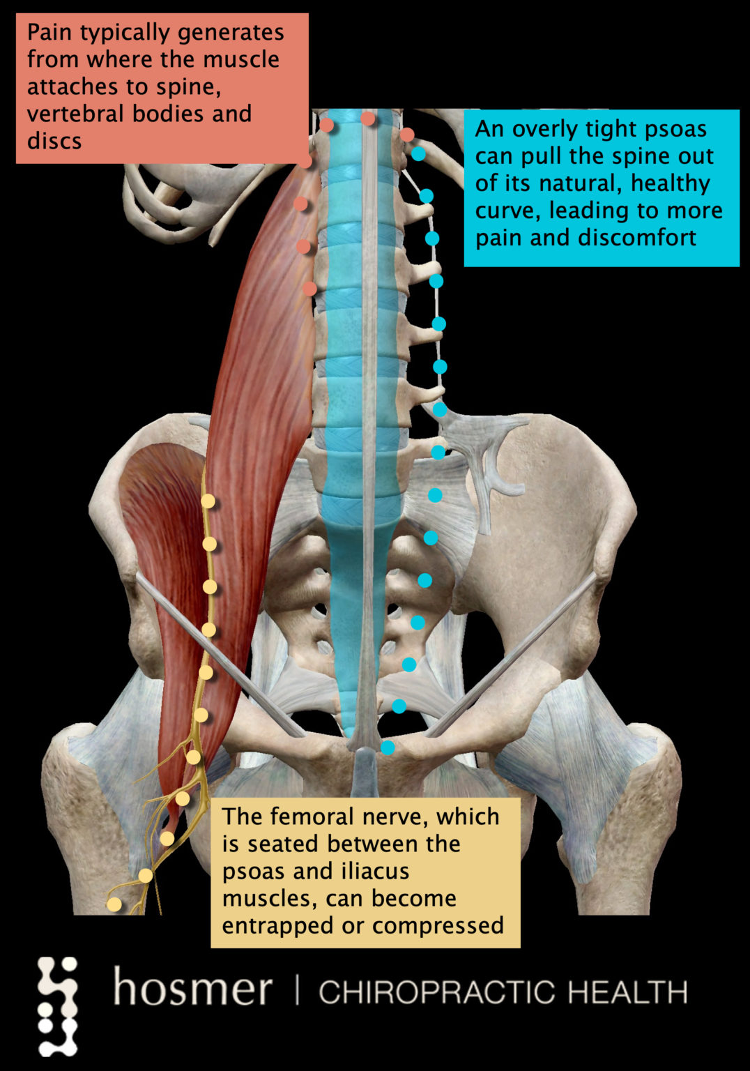 Psoas Muscle And Vagus Nerve Image To U