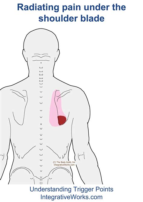 Right Upper Quadrant Pain Radiating To Back