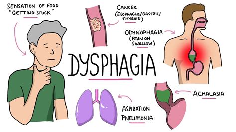 Sore Throat And Painful Swallowing Case Report Youtube