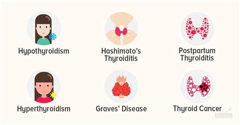 The Ultimate 5Step Guide To Thyroid Health For Men Excel Web