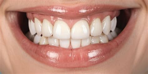 Ultimate Guide: 10 Steps To A Brighter Smile Now