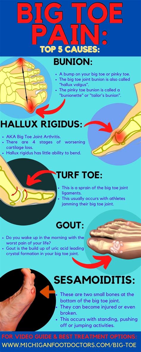 Ultimate Guide To Relieving Throbbing Big Toe Pain Now