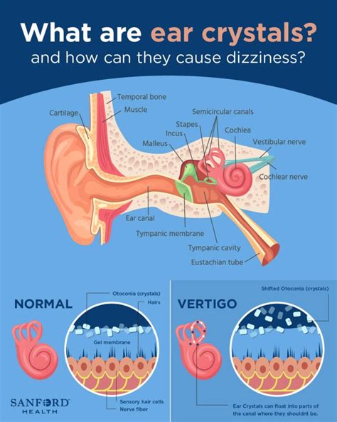 Understanding Dizziness And Vertigo Causes Symptoms And Management