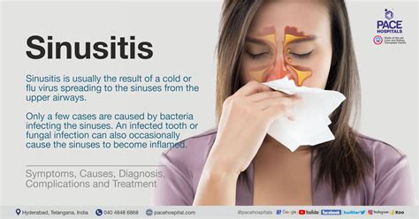 What Is Sinusitis Prevention And Treatment For Sinusitis