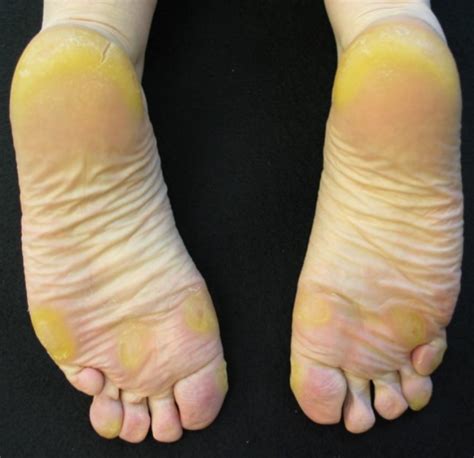 Yellow Color Bottom Of Feet